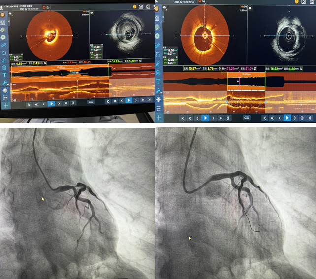 1678779777123149.png W020230213568949354451.png