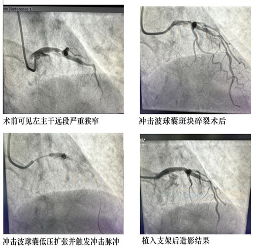 1681529751177329.jpg 微信圖片_20230415112826.jpg
