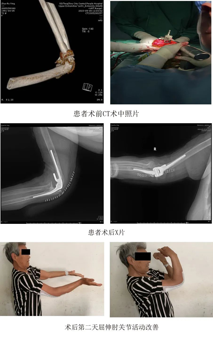 1685092367824109.jpg 640 (3).jpg