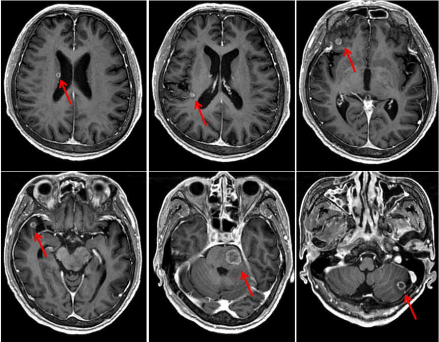 1692000095121807.png 640 (1).png