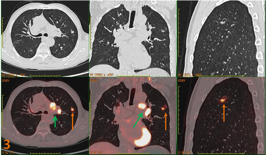 1692000153985930.png 640 (2).png