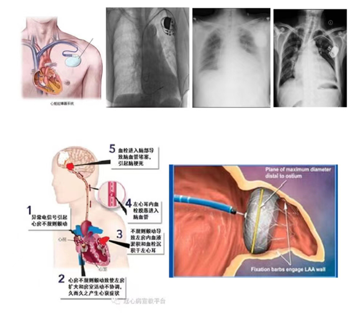 1699348850206780.jpg 微信圖片_20231107171015.jpg