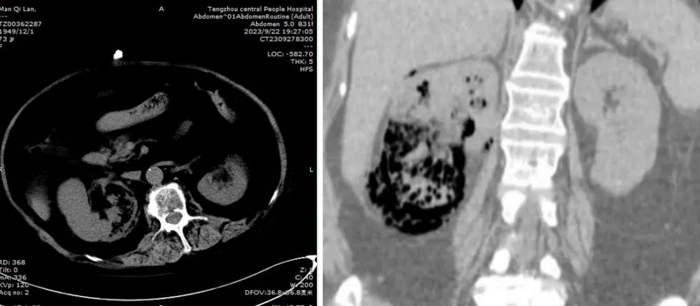 1699519425366368.jpg 640 (1).jpg