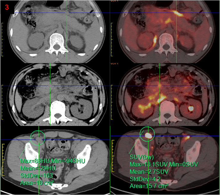 1702090380994644.png 3.png