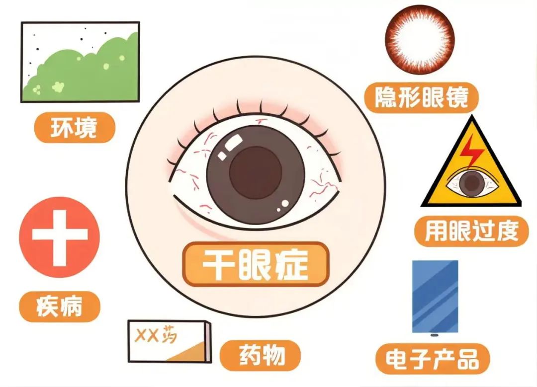 干眼癥的危險(xiǎn)因素.jpg