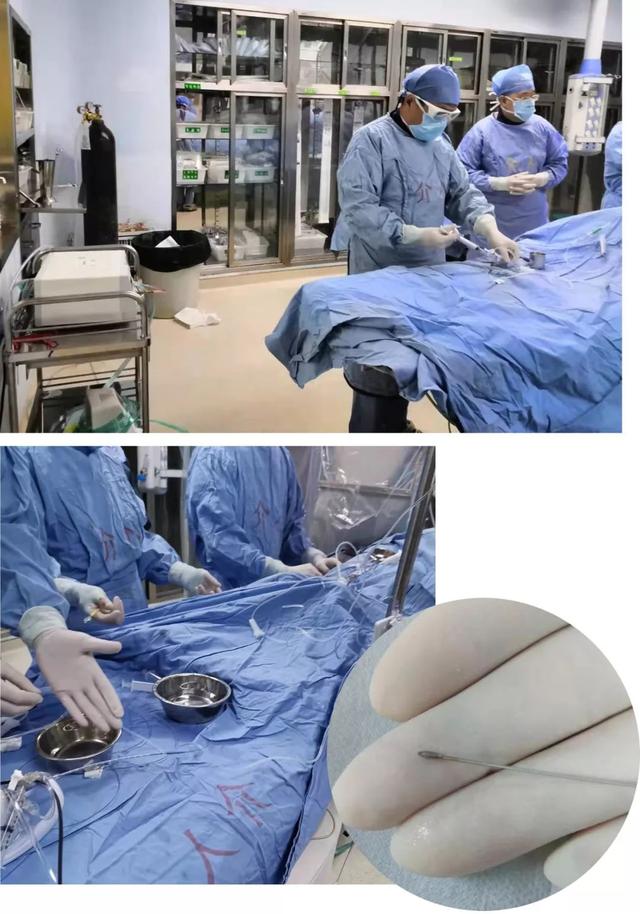 我院心內(nèi)科成功開展我市首例冠狀動(dòng)脈旋磨術(shù)與血管內(nèi)超聲檢測技術(shù)