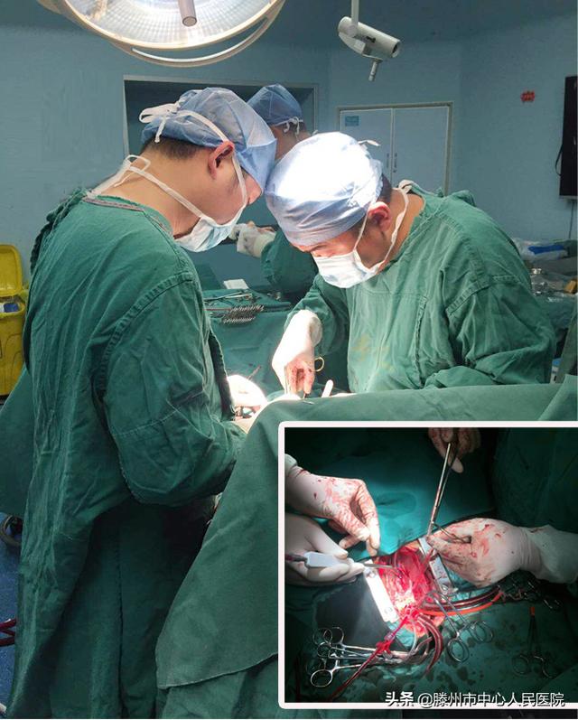 滕州市中心人民醫(yī)院成功開展體外循環(huán)下心臟直視手術(shù)